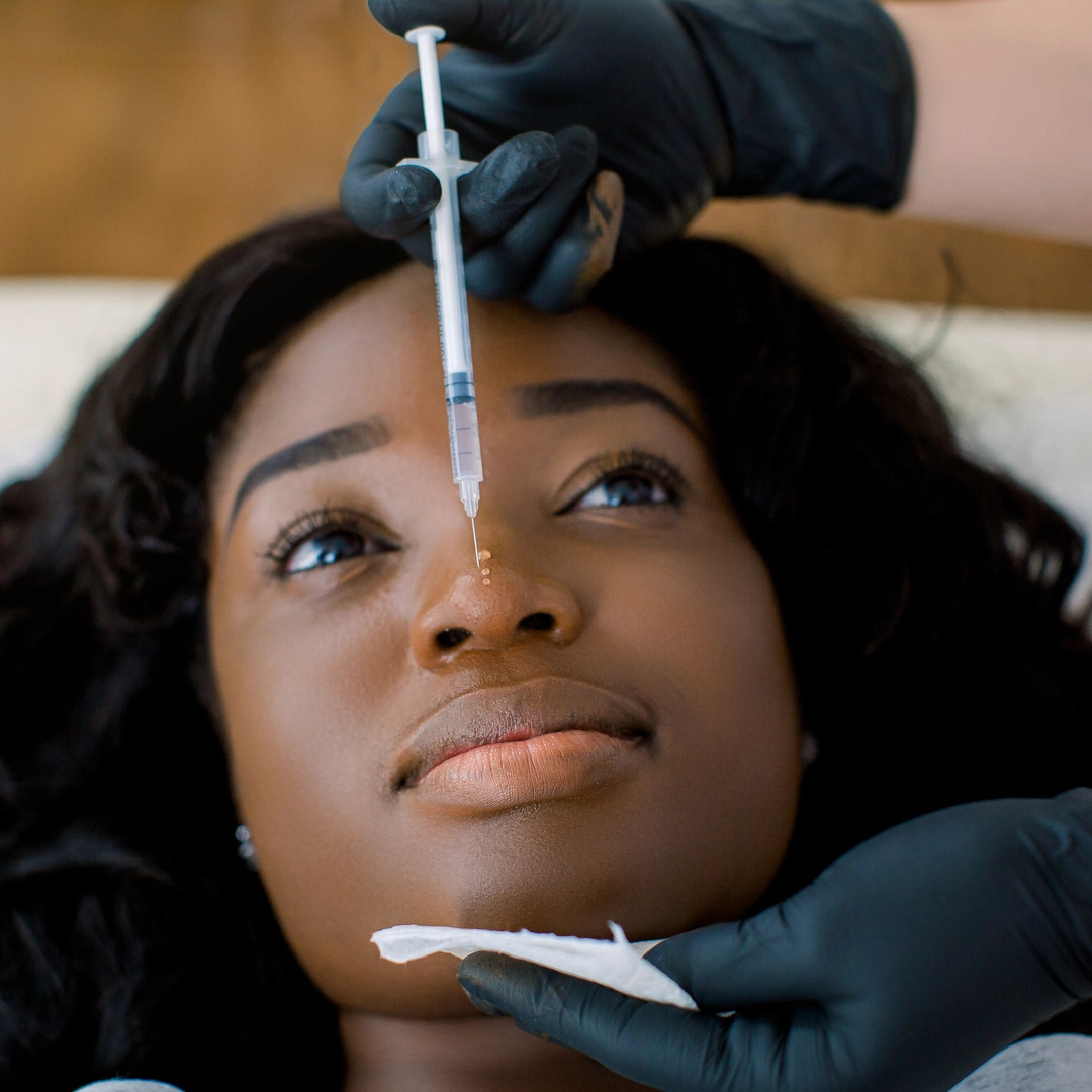 Dermal fillers
