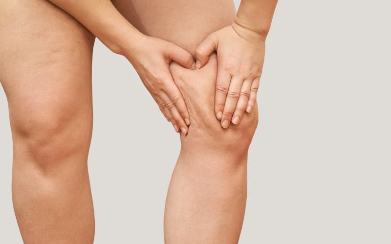 Knees: Lift sagging skin above the knees