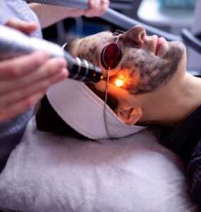 Laser Therapy