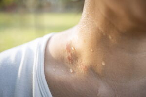 Close-up of a sweaty neck with droplets on tan skin, wearing a white shirt outdoors.