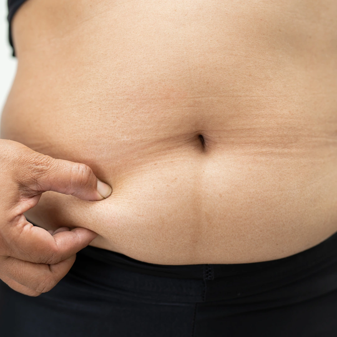 Stubborn Tummy Fat