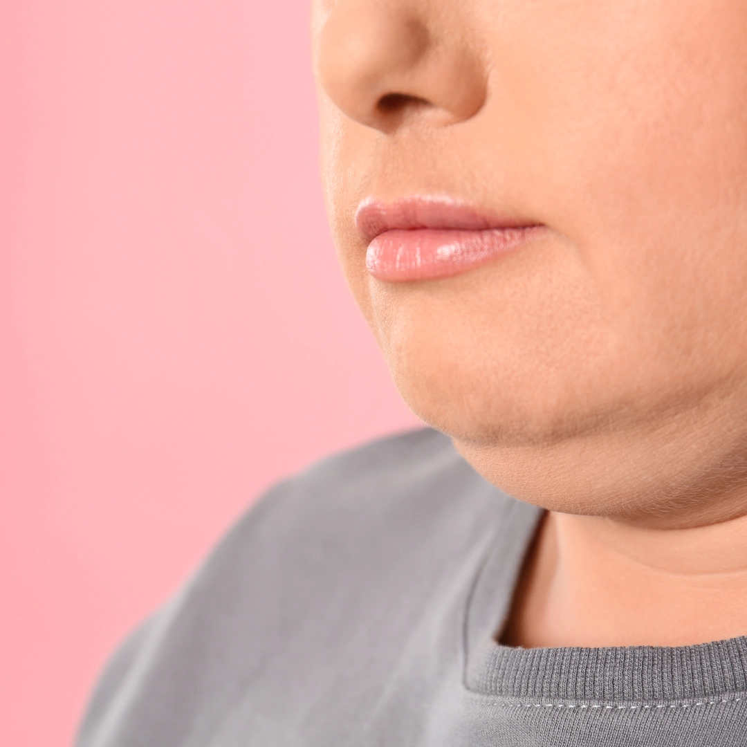 Double chin / turkey neck