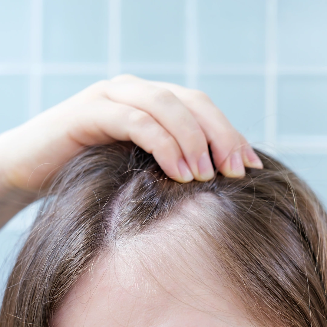 hairfall solution
