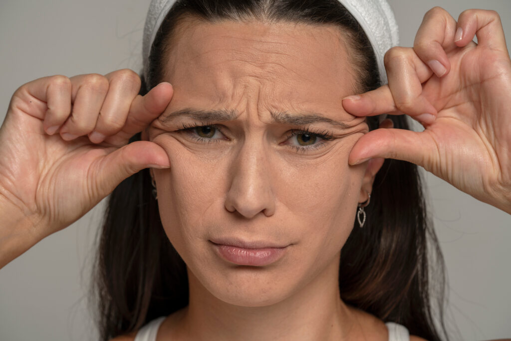Anti-wrinkle injection sites