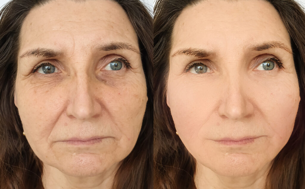 Natural looking results without loss of expression