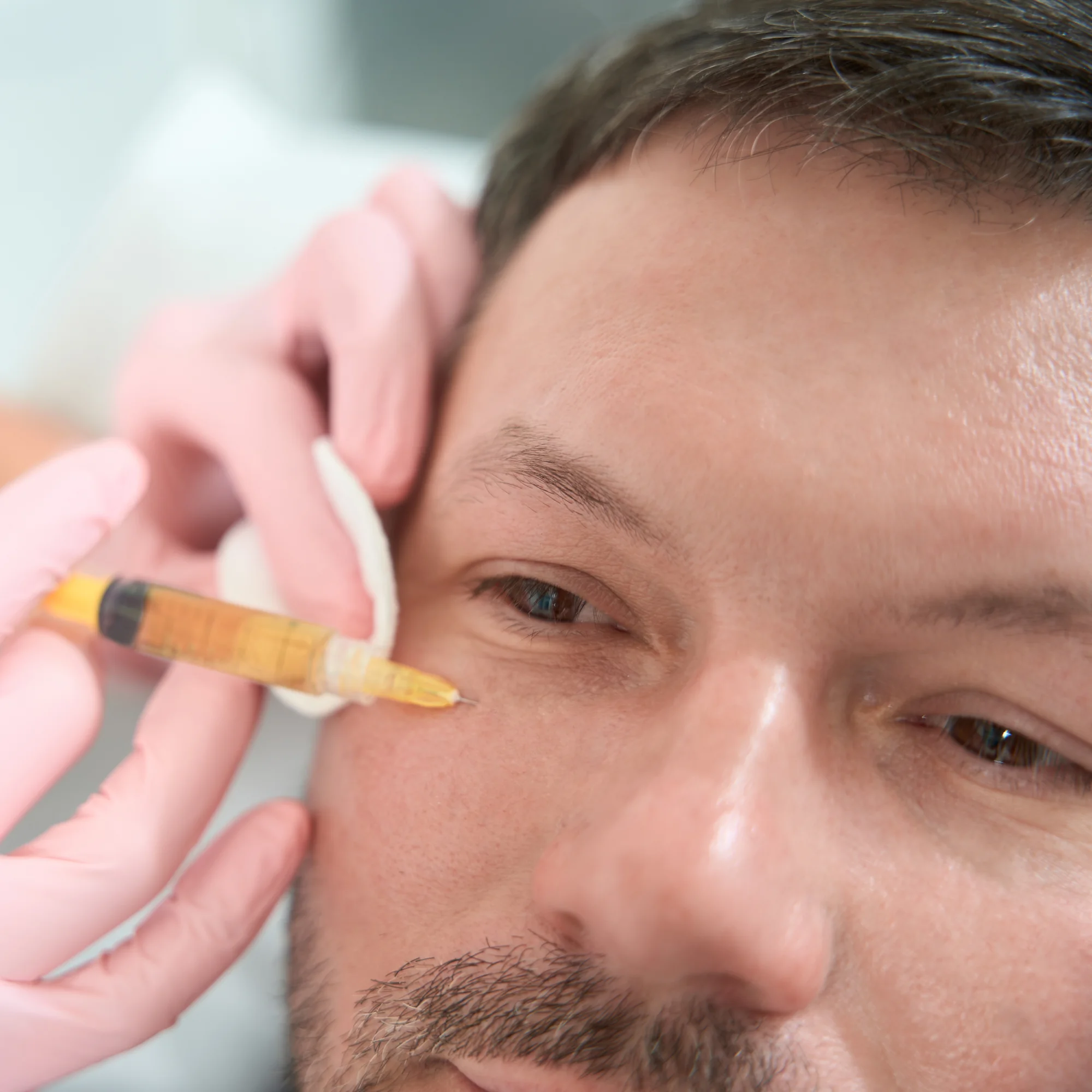 PRF Treatment